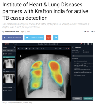 IHLD, Krafton India partner for TB detection in Uttarakhand, UP